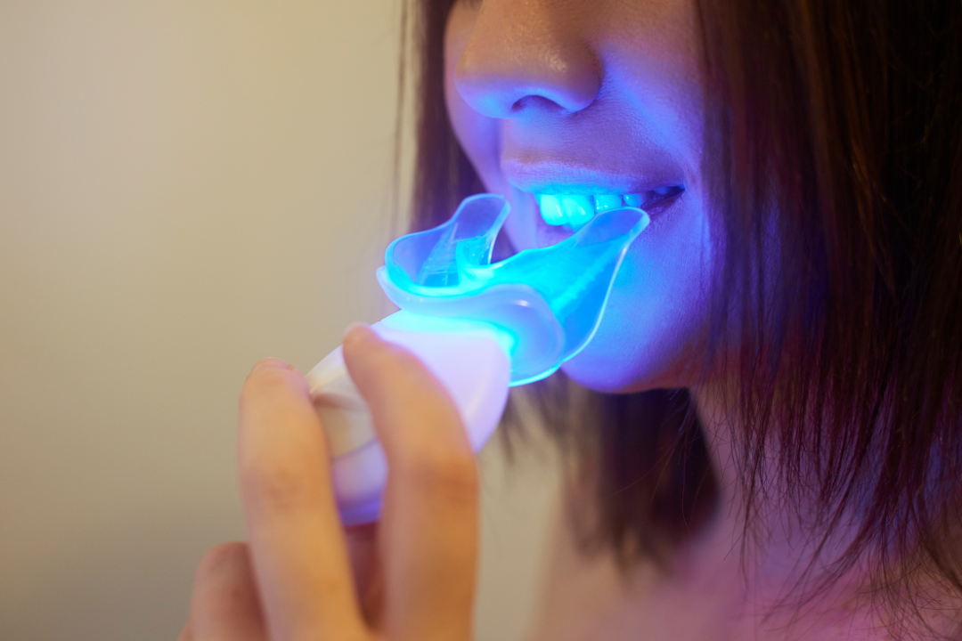 The Power of Hydrogen Peroxide: Teeth Whitening Unveiled