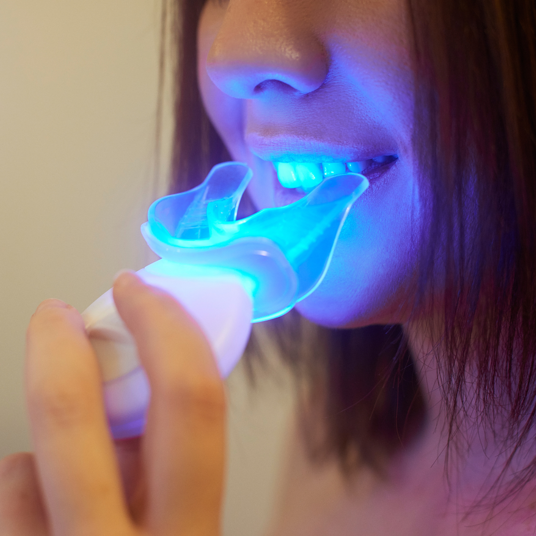 WhiteBlanc Light-Enhanced Teeth Whitening Kit